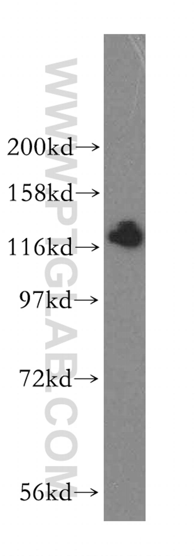 HIP1R Antibody in Western Blot (WB)