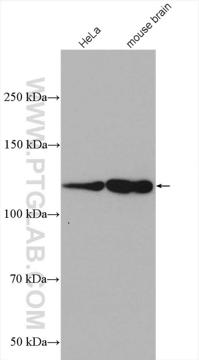 HIP1R Antibody in Western Blot (WB)