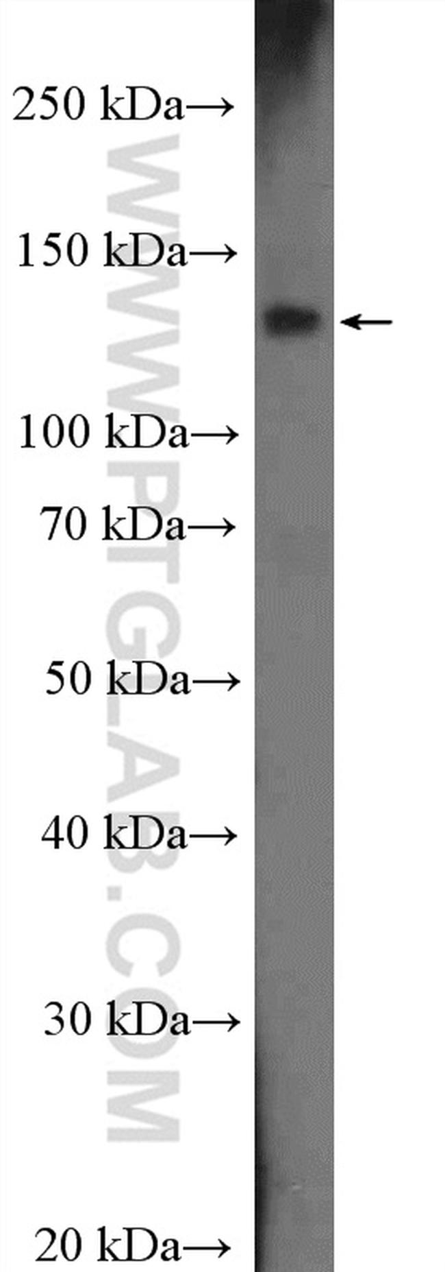 HIP1R Antibody in Western Blot (WB)