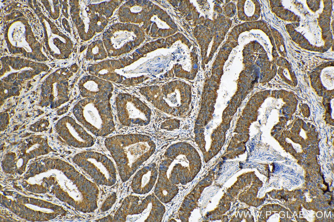 p130Cas Antibody in Immunohistochemistry (Paraffin) (IHC (P))