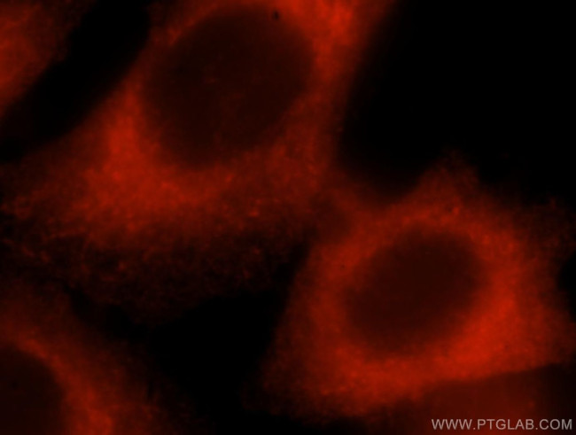 p130Cas Antibody in Immunocytochemistry (ICC/IF)