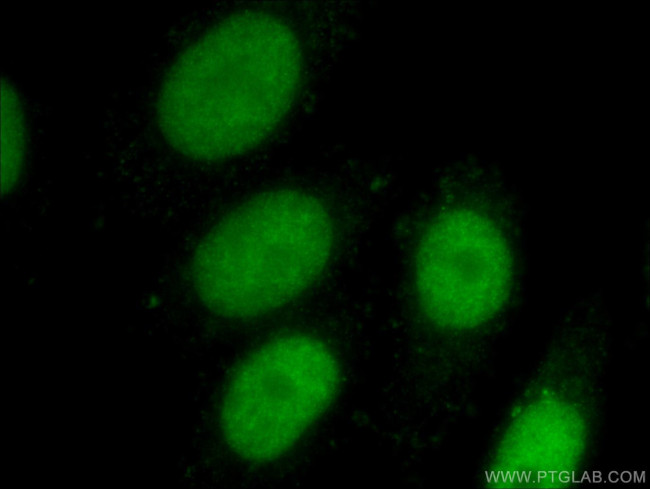 EED Antibody in Immunocytochemistry (ICC/IF)