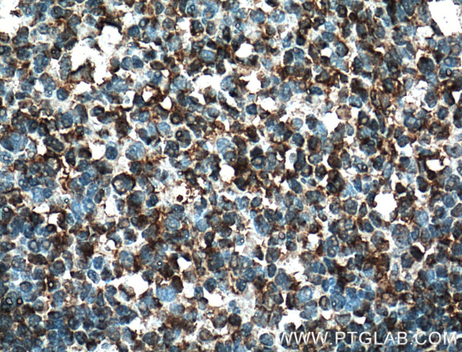 EED Antibody in Immunohistochemistry (Paraffin) (IHC (P))