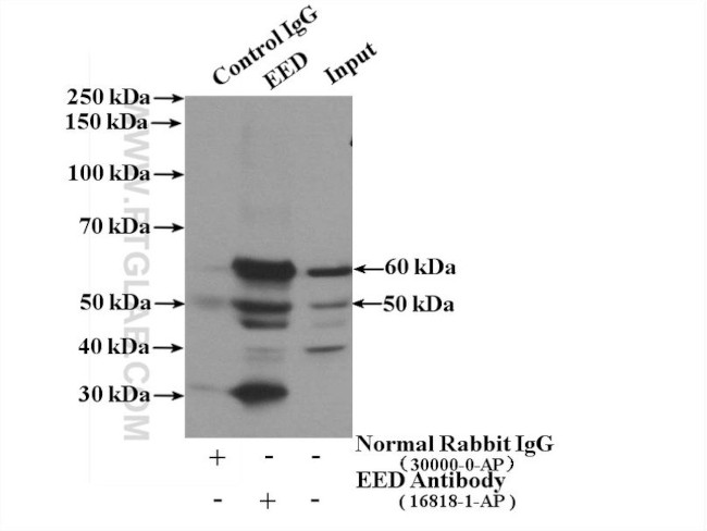 EED Antibody in Immunoprecipitation (IP)