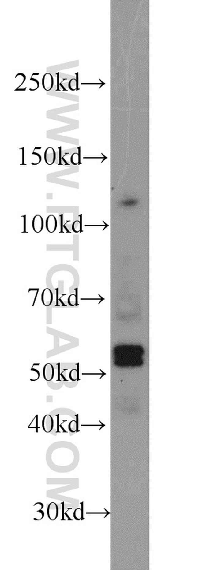 EED Antibody in Western Blot (WB)