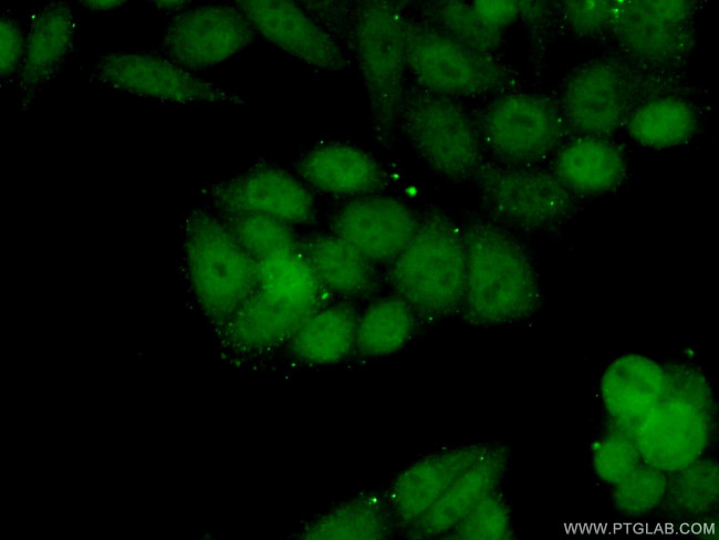 SRF Antibody in Immunocytochemistry (ICC/IF)