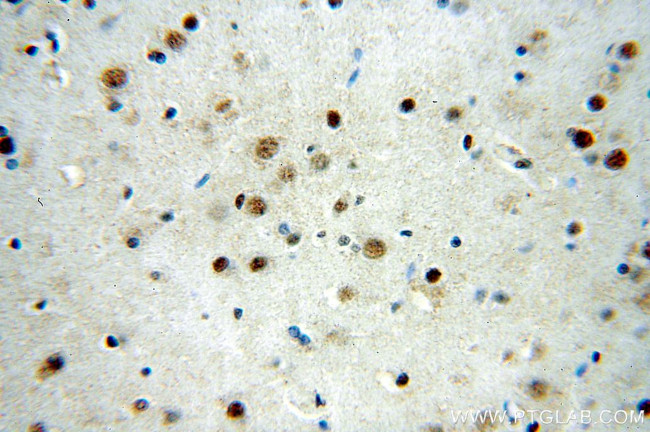 SRF Antibody in Immunohistochemistry (Paraffin) (IHC (P))