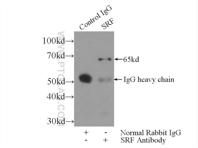 SRF Antibody in Immunoprecipitation (IP)