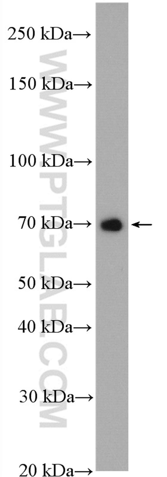 SRF Antibody in Western Blot (WB)