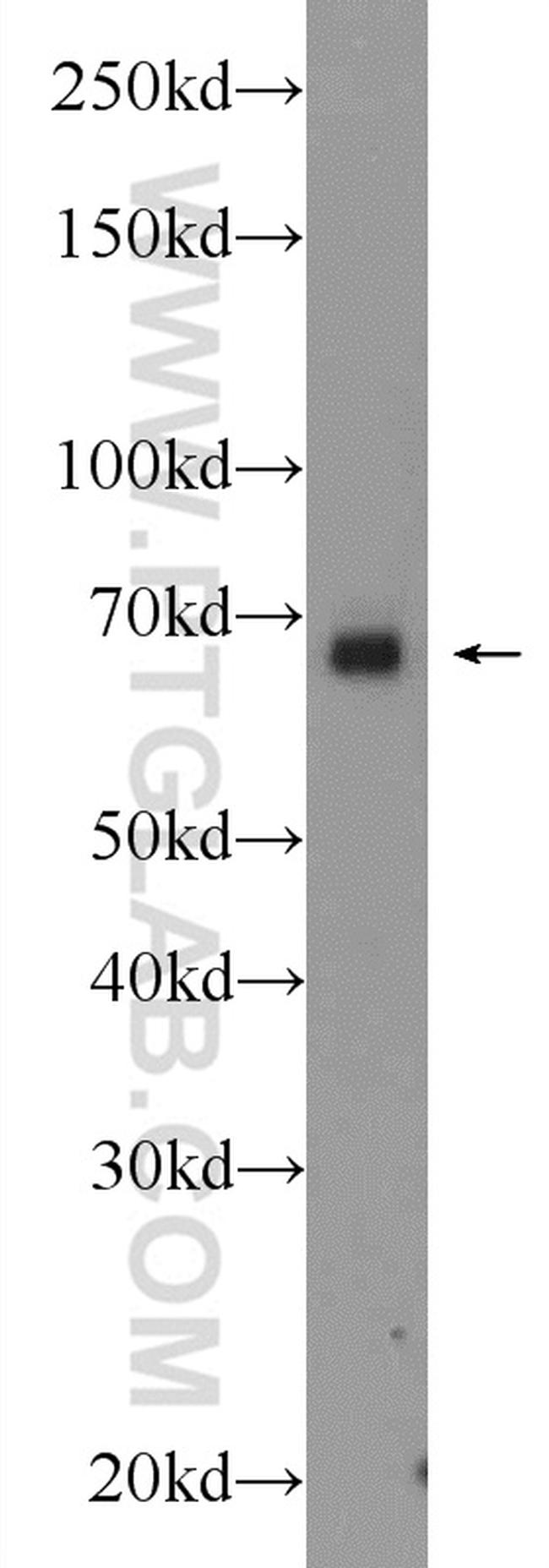 SRF Antibody in Western Blot (WB)