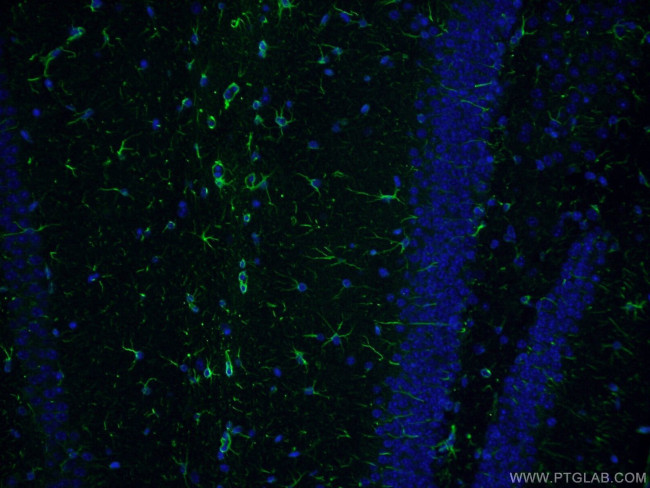 GFAP Antibody in Immunohistochemistry (PFA fixed) (IHC (PFA))