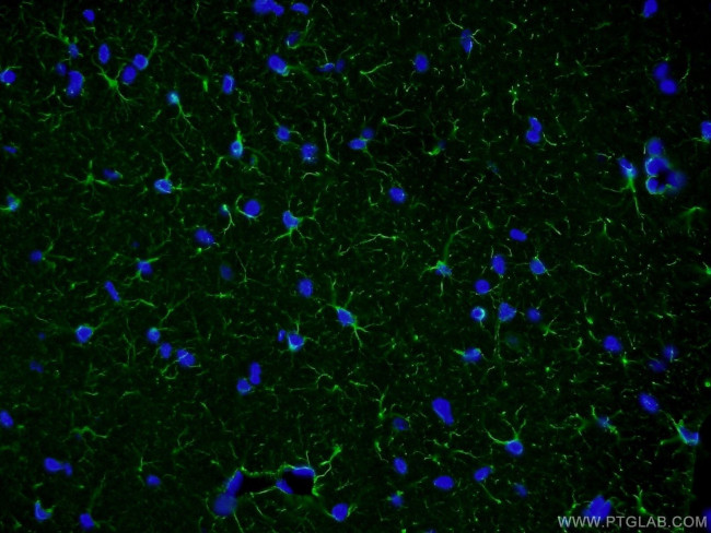 GFAP Antibody in Immunohistochemistry (PFA fixed) (IHC (PFA))