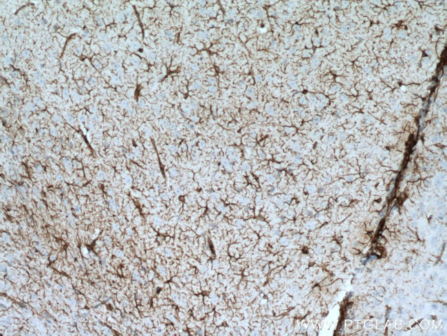 GFAP Antibody in Immunohistochemistry (Paraffin) (IHC (P))