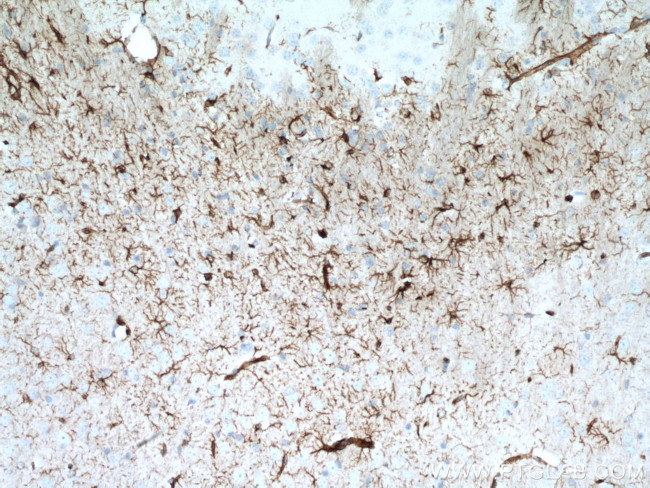 GFAP Antibody in Immunohistochemistry (Paraffin) (IHC (P))