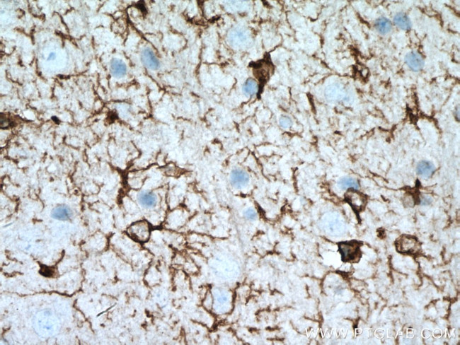 GFAP Antibody in Immunohistochemistry (Paraffin) (IHC (P))