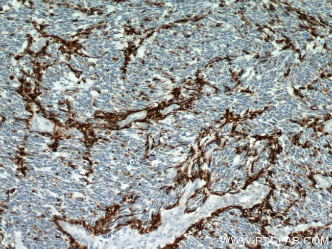 GFAP Antibody in Immunohistochemistry (Paraffin) (IHC (P))