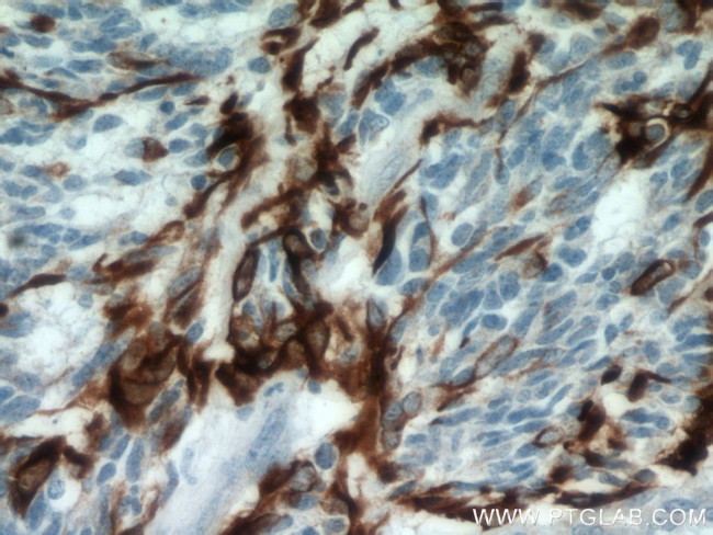 GFAP Antibody in Immunohistochemistry (Paraffin) (IHC (P))