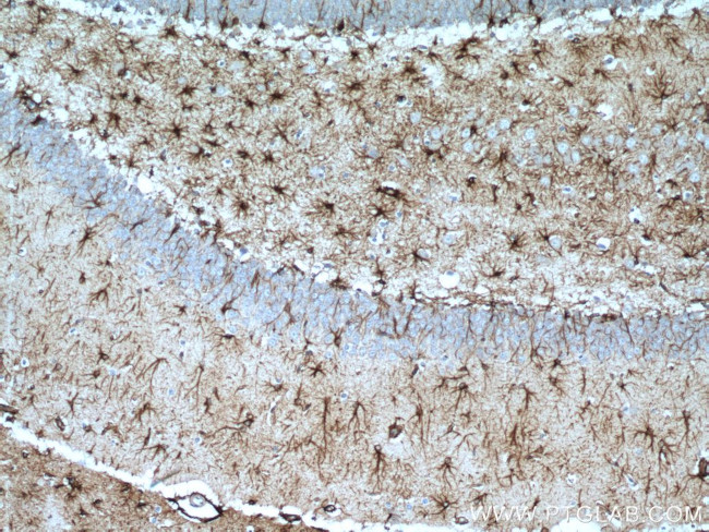 GFAP Antibody in Immunohistochemistry (Paraffin) (IHC (P))