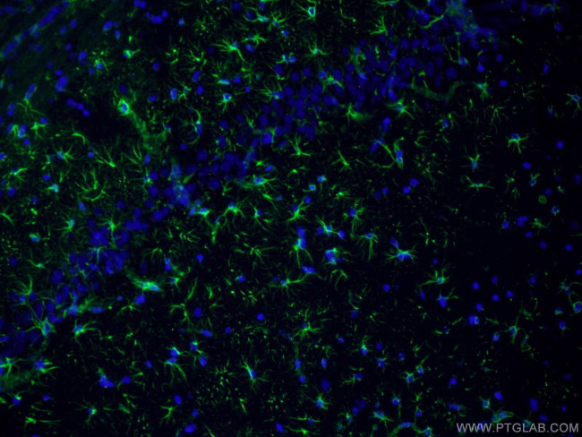 GFAP Antibody in Immunohistochemistry (PFA fixed) (IHC (PFA))