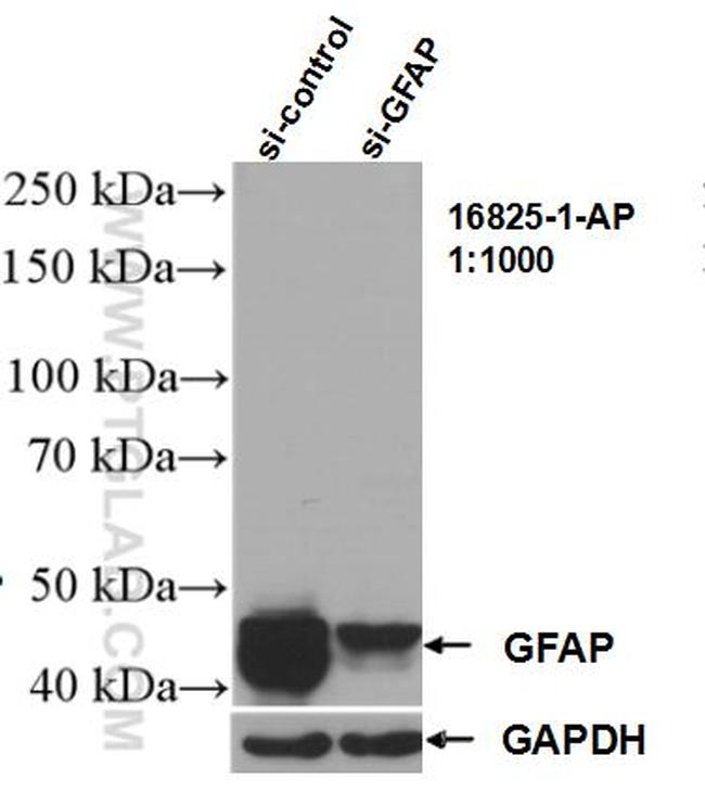 GFAP Antibody in Western Blot (WB)