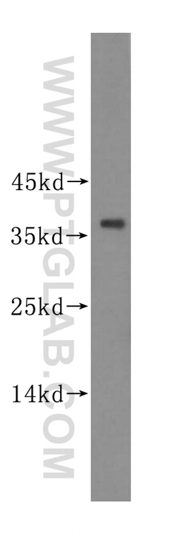 PIK3IP1 Antibody in Western Blot (WB)