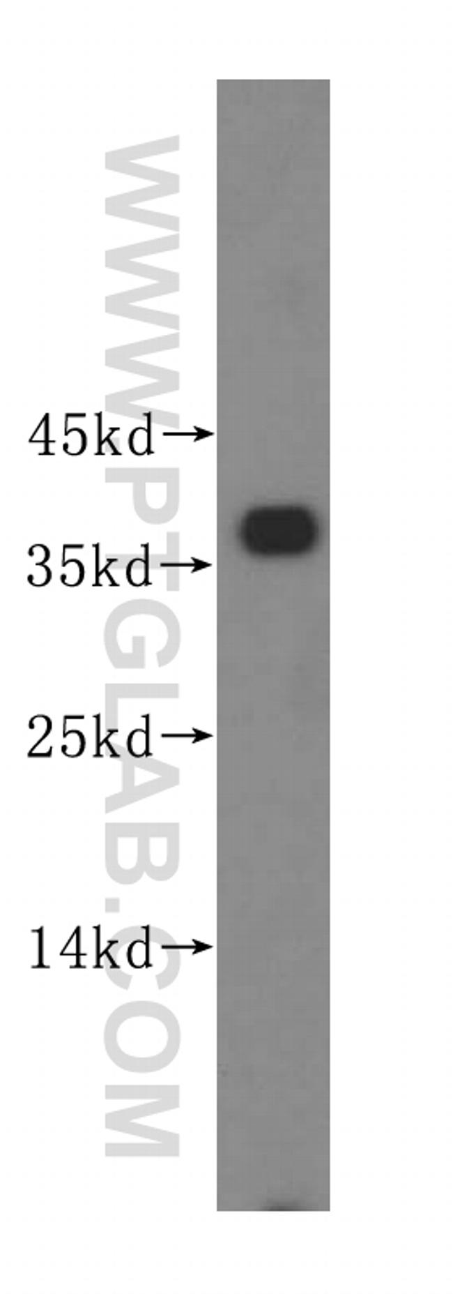 PIK3IP1 Antibody in Western Blot (WB)