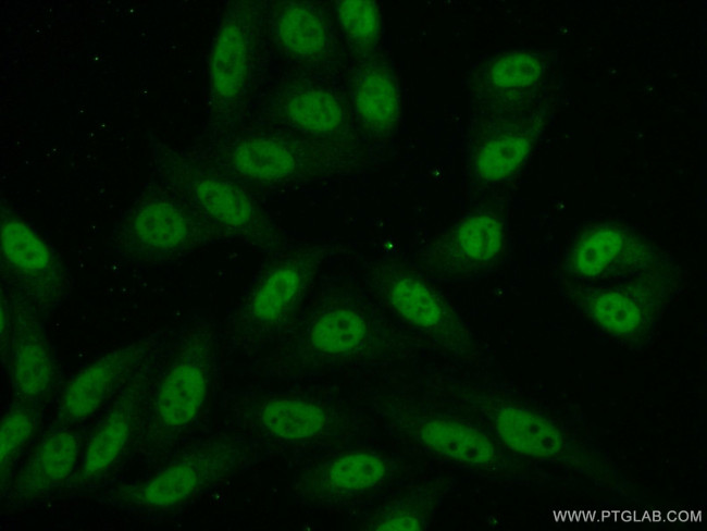 NCAPD3 Antibody in Immunocytochemistry (ICC/IF)