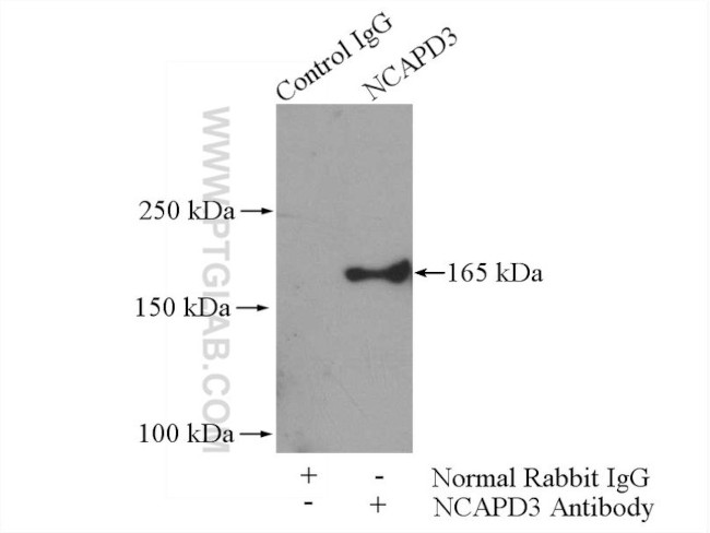 NCAPD3 Antibody in Immunoprecipitation (IP)