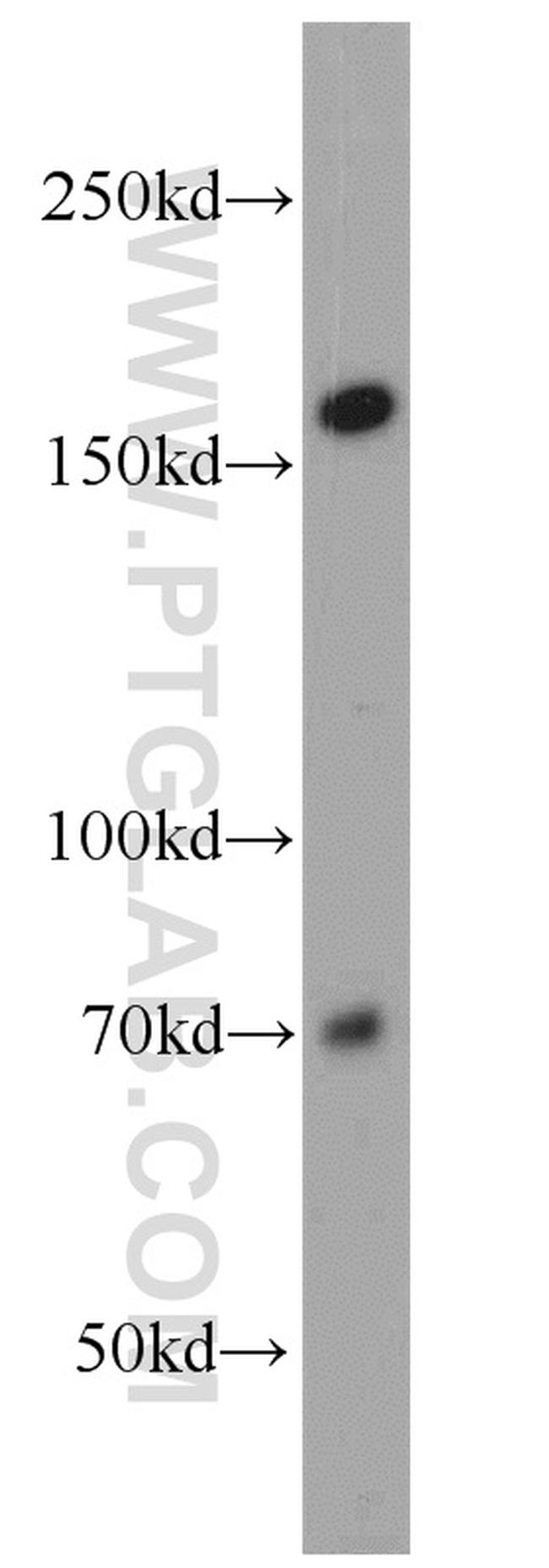 NCAPD3 Antibody in Western Blot (WB)