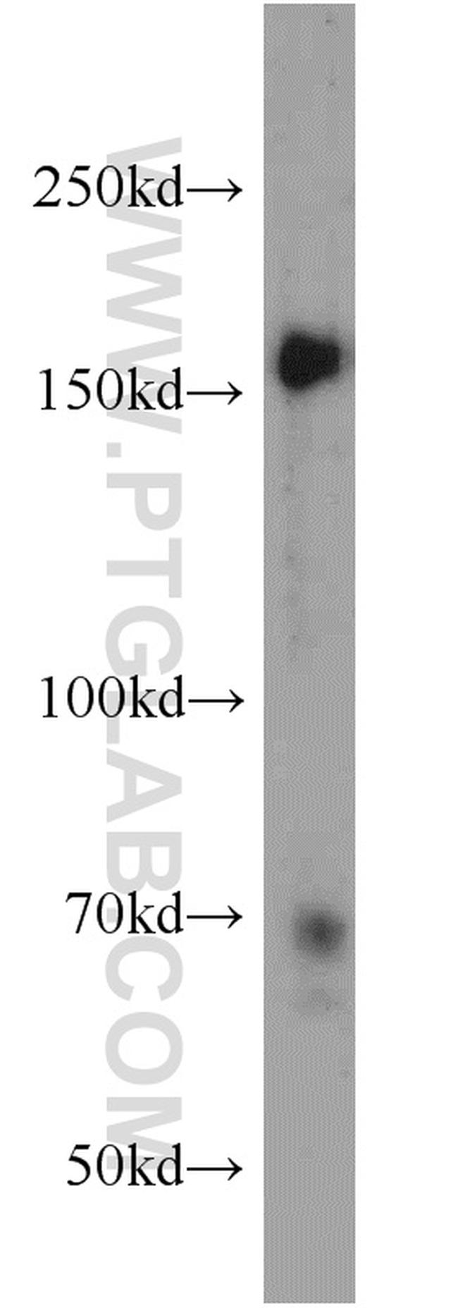 NCAPD3 Antibody in Western Blot (WB)