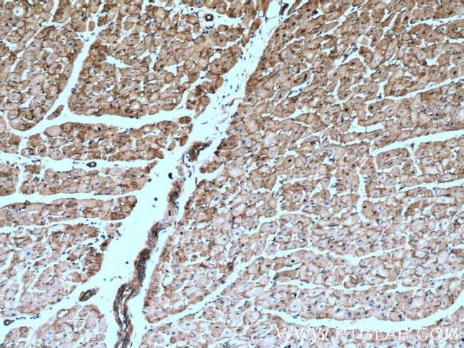 ATP1A2 Antibody in Immunohistochemistry (Paraffin) (IHC (P))