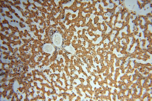 ATP1A2 Antibody in Immunohistochemistry (Paraffin) (IHC (P))