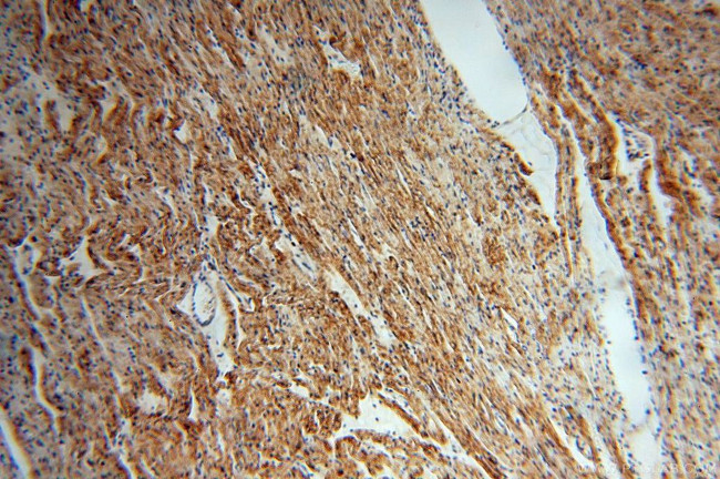 ATP1A2 Antibody in Immunohistochemistry (Paraffin) (IHC (P))