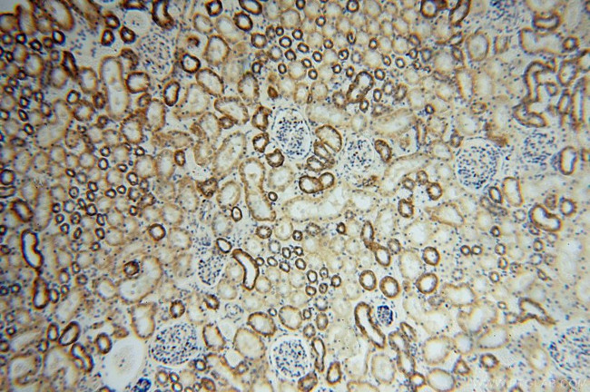 ATP1A2 Antibody in Immunohistochemistry (Paraffin) (IHC (P))