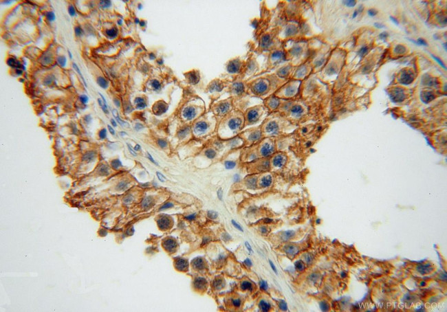 ATP1A2 Antibody in Immunohistochemistry (Paraffin) (IHC (P))