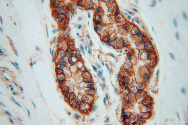 ATP1A2 Antibody in Immunohistochemistry (Paraffin) (IHC (P))