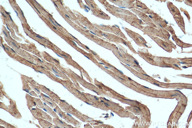 ATP1A2 Antibody in Immunohistochemistry (Paraffin) (IHC (P))