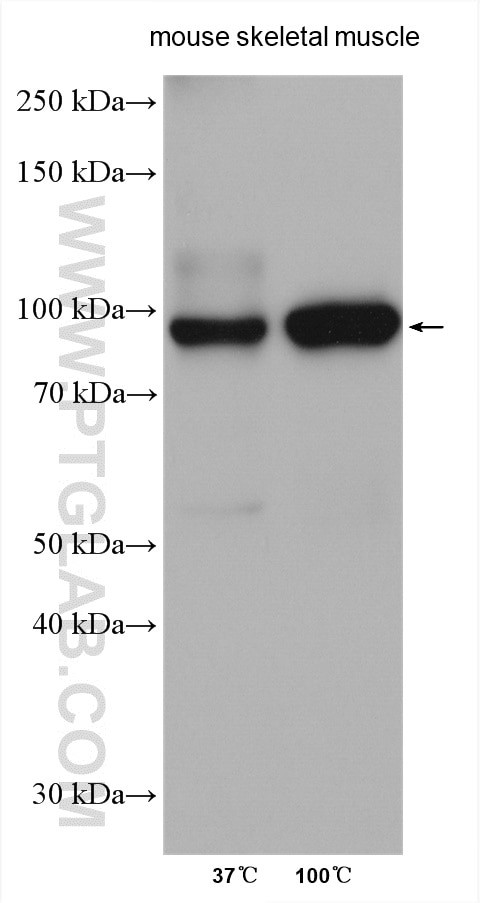 ATP1A2 Antibody in Western Blot (WB)