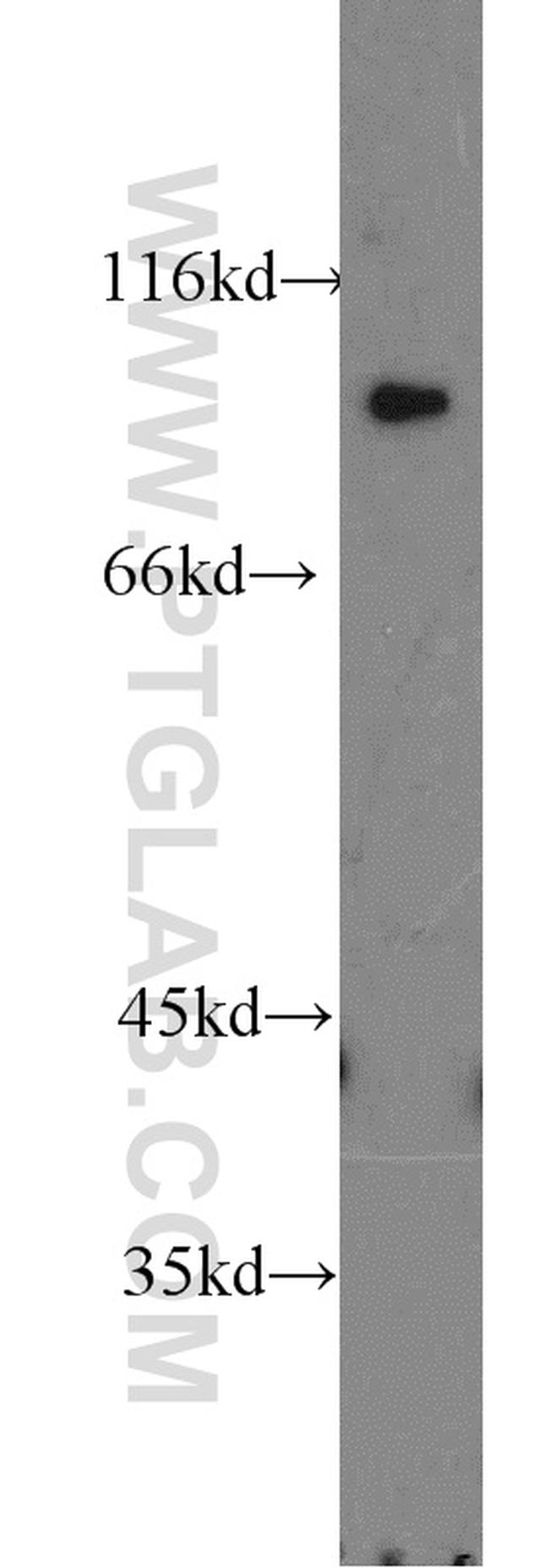 ATP1A2 Antibody in Western Blot (WB)