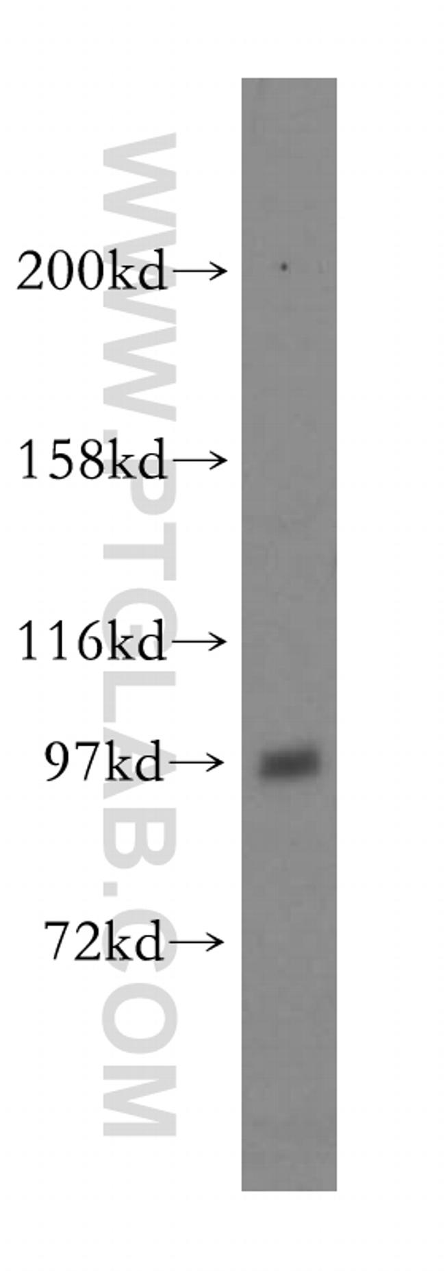 ATP1A2 Antibody in Western Blot (WB)