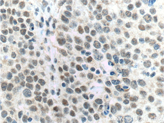 ALKBH5 Antibody in Immunohistochemistry (Paraffin) (IHC (P))