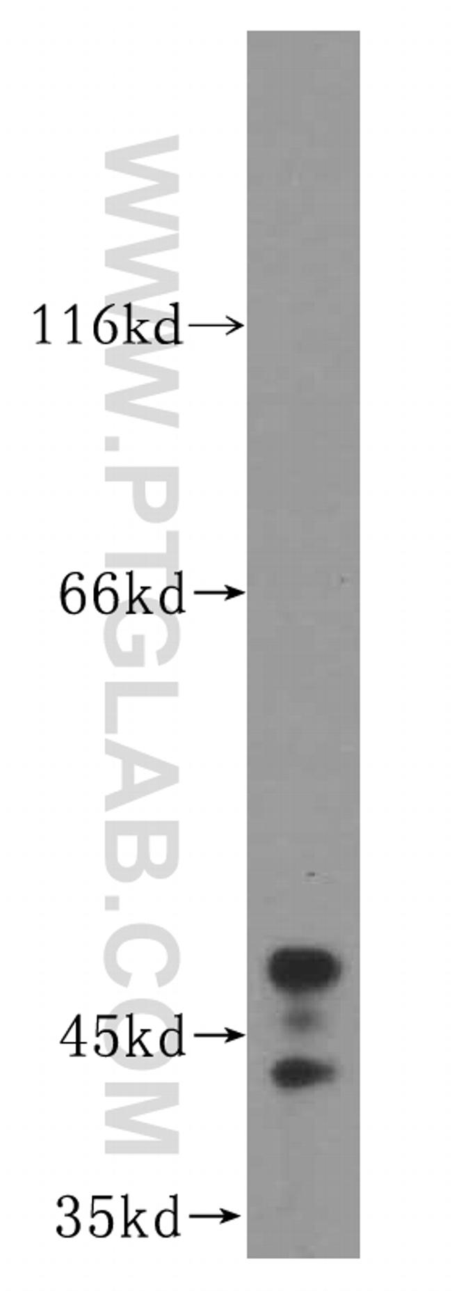 ALKBH5 Antibody in Western Blot (WB)