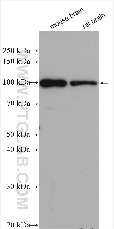 JAKMIP2 Antibody in Western Blot (WB)