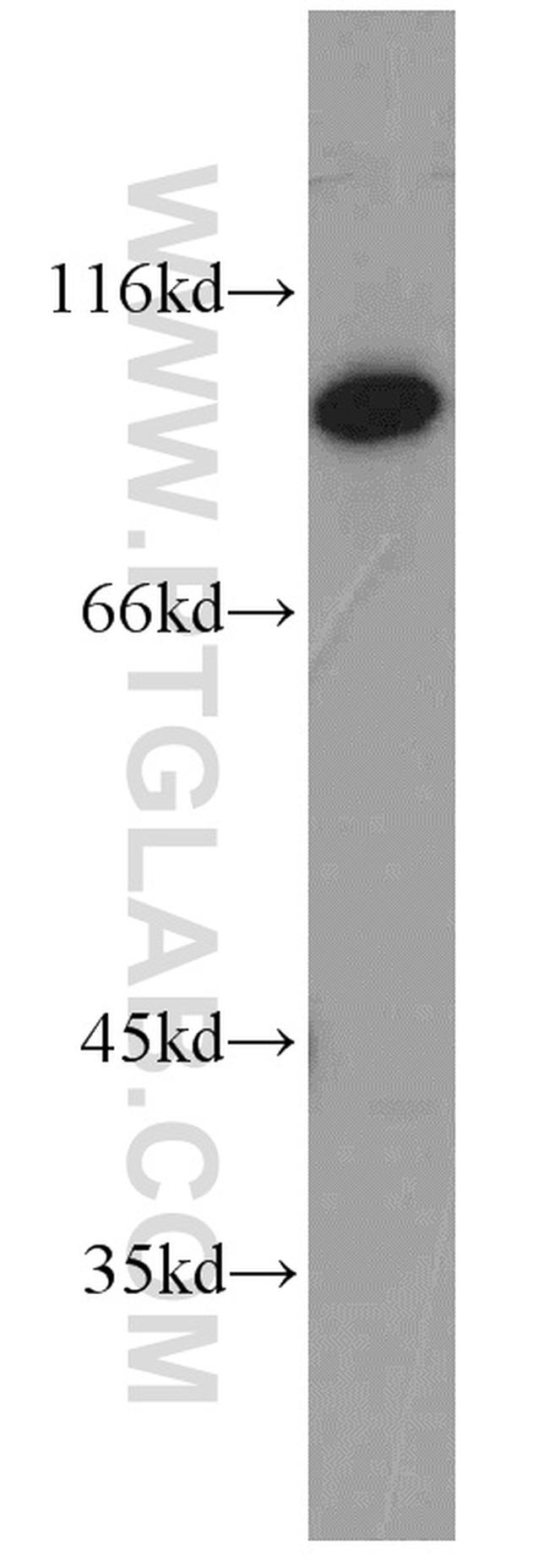 JAKMIP2 Antibody in Western Blot (WB)