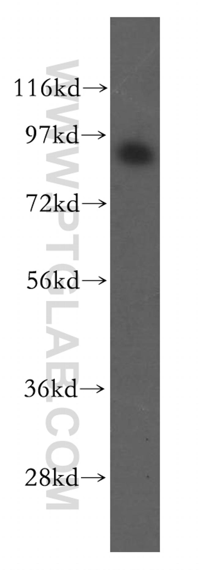 JAKMIP2 Antibody in Western Blot (WB)