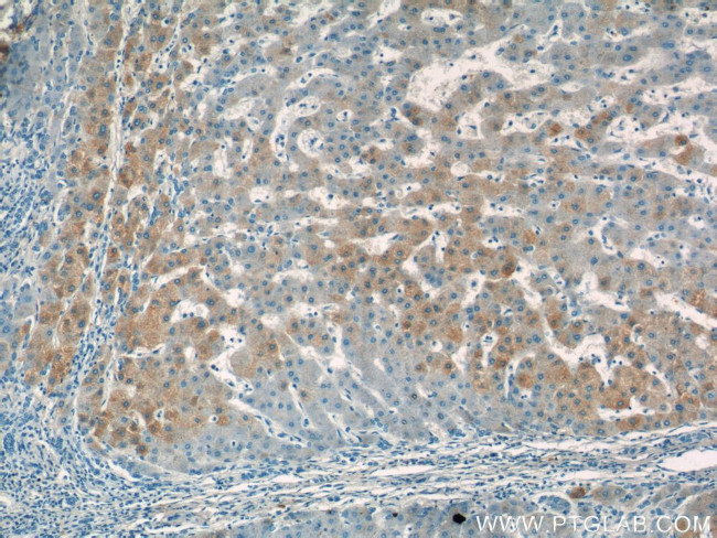 Apolipoprotein A II Antibody in Immunohistochemistry (Paraffin) (IHC (P))