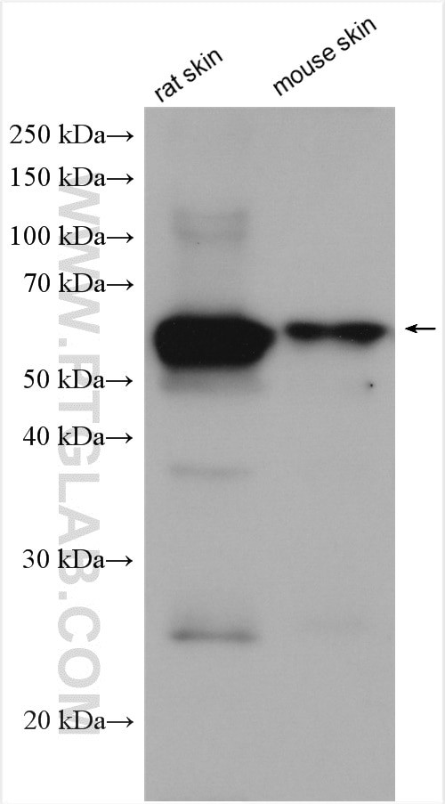 Cytokeratin 1 Antibody in Western Blot (WB)