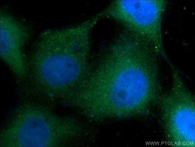 Cytokeratin 1 Antibody in Immunocytochemistry (ICC/IF)