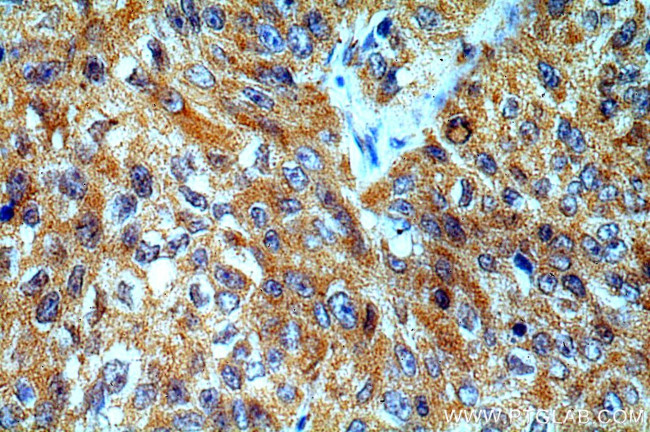 Cytokeratin 1 Antibody in Immunohistochemistry (Paraffin) (IHC (P))