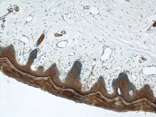 Cytokeratin 1 Antibody in Immunohistochemistry (Paraffin) (IHC (P))